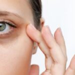 Effective home remedies to lighten dark circles