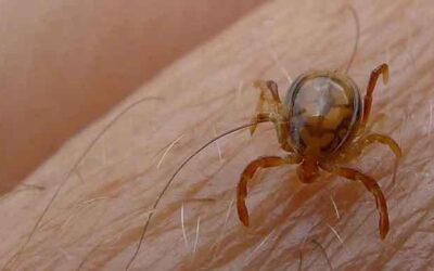 Two doctors at Karachi’s Jinnah Hospital feared to have contracted Congo virus