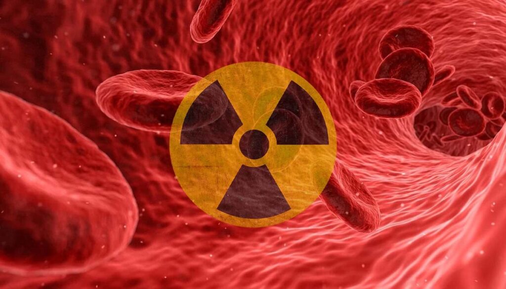 How radiation affects pap smears